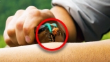 What It’s Like to Be Stung by a Murder Hornet