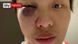 Coronavirus: Hate crimes against Chinese people in the UK on the rise