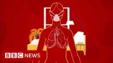 Coronavirus: How long does it take to recover?
